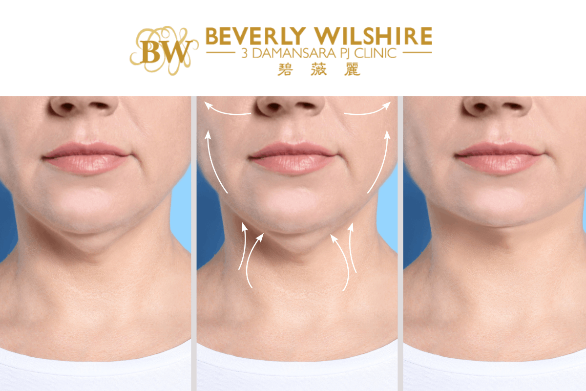 Sagging Skin Beverly Wilshire Clinic